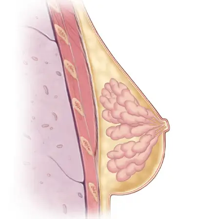 Breast Cancer Stem Cells