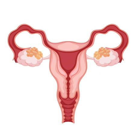 ovarian cancer surgery - ovarian cancer stem cell therapy