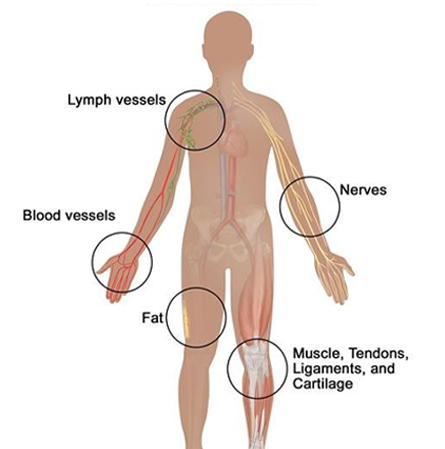 Sarcoma Cancer Stem Cells - stem cell therapy - stem cell tijuana - baja integrative center