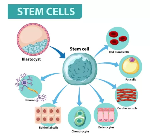 mesenchymal stem cells treatment - mesenchymal stem cells therapy - msc therapies